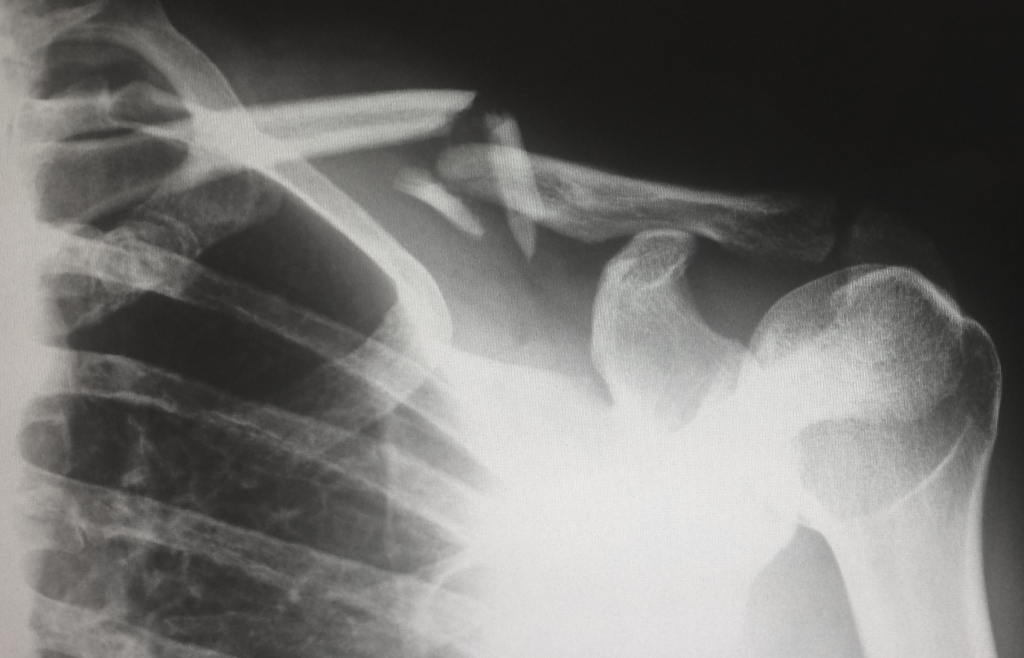 Building the Future of Healthcare: A Deep Dive into Telemedicine Software Development 3 Human X-ray result