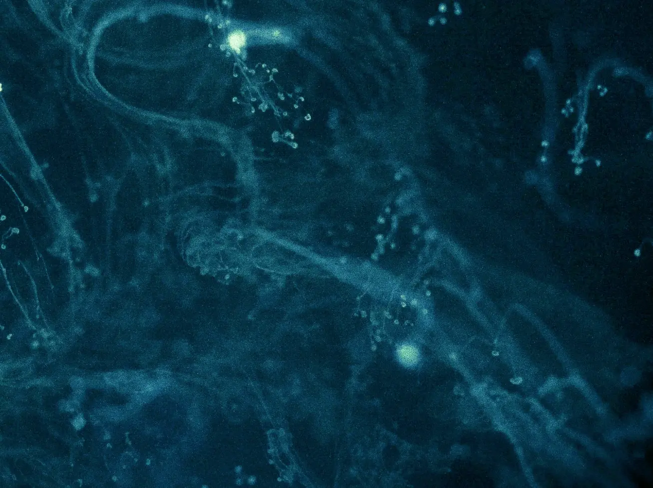 The Rise of the AI Health Coach: Transforming Wellness and Optimizing Healthcare Workflows